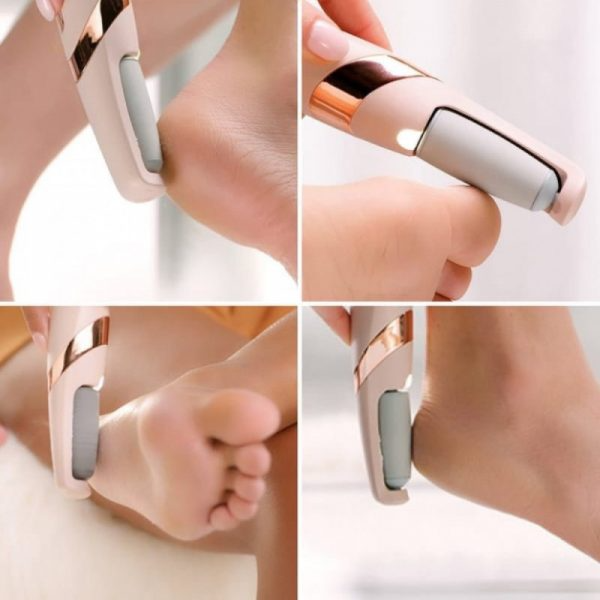 جهاز تنعيم القدمين - الصورة 2